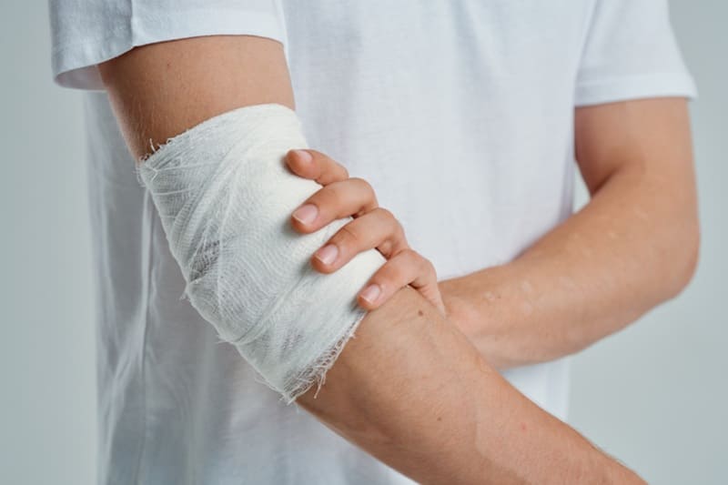 Atención de hernias, úlceras y quemaduras en Cuernavaca, Morelos